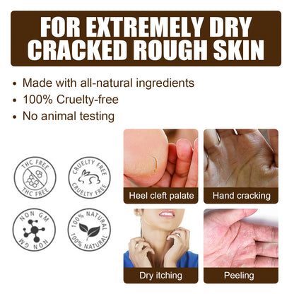 South Moon Cracked Heel Care Cream, Repair Foot Anti-Cracking, Peeling And Chapping Moisturizing Foot Cream