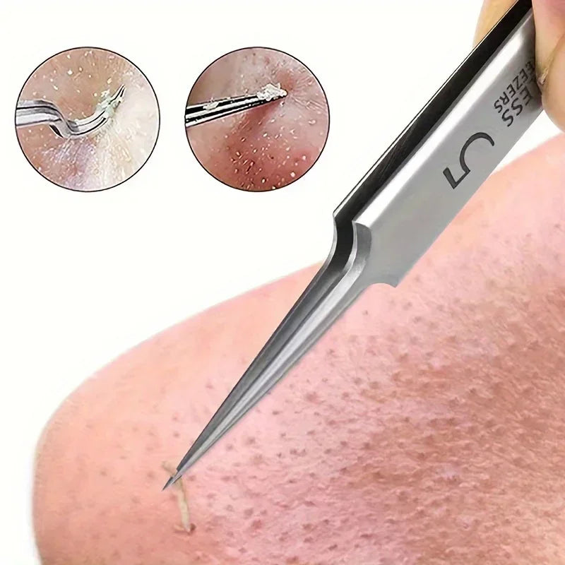 German 1/3/8Pack Extra Fine No. 5 Cellular Acne Blackhead Tweezers - Facial Beauty Remove Acne Needle Tools for Skin Care Tools